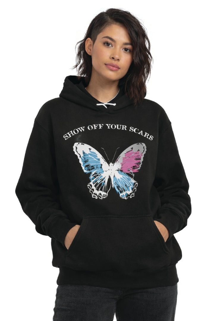 Show Off Your Scars Hoodie